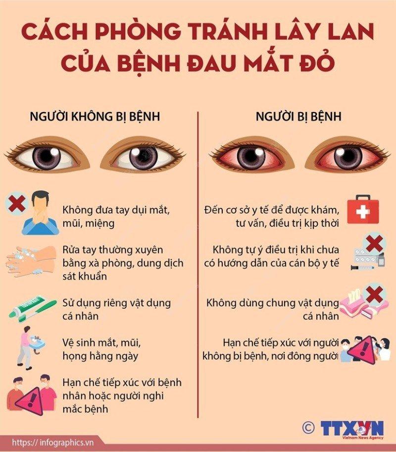 Bản tin tuyên truyền: Phòng, chống bệnh đau mắt đỏ